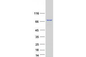 Western Blotting (WB) image for Protein Regulator of Cytokinesis 1 (PRC1) (Transcript Variant 1) protein (Myc-DYKDDDDK Tag) (ABIN2729555)