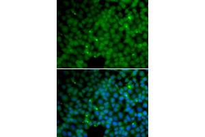 Immunofluorescence analysis of HeLa cells using GGH antibody (ABIN5973177). (GGH Antikörper)