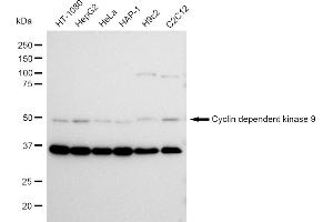 Western blotting analysis using Cyclin dependent kinase 9 antibody (ABIN7798221).