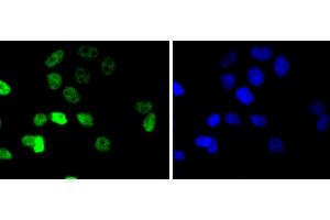 MCF-7 cells were stained with Cyclin E1 (4H7) Monoclonal Antibody  at [1:200] incubated overnight at 4C, followed by secondary antibody incubation, DAPI staining of the nuclei and detection. (Cyclin E1 Antikörper)