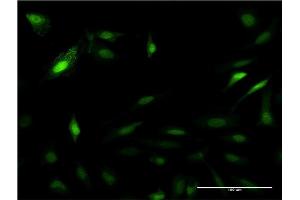 Immunofluorescence of monoclonal antibody to PSME2 on HeLa cell.