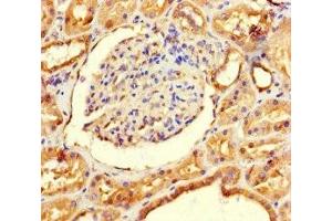 Immunohistochemistry of paraffin-embedded human kidney tissue using ABIN7143697 at dilution of 1:100 (GALM Antikörper  (AA 2-342))