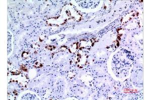 Immunohistochemistry (IHC) image for anti-Keratin 8 (KRT8) (Ser726), (Ser731) antibody (ABIN3187841)