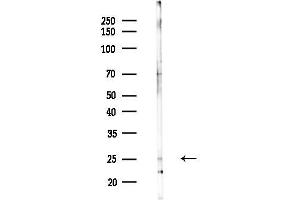Western blot analysis of lysates from Mouse liver, using Dectin-1 Antibody at 1/1000 dilution.