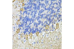 Immunohistochemistry of paraffin-embedded mouse cerebellum using C antibody  at dilution of 1:100 (40x lens). (CA8 Antikörper  (AA 1-290))