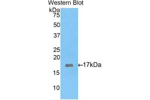 Western blot analysis of the recombinant protein. (GAD Antikörper  (AA 1-97))