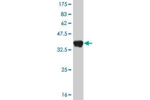 Western Blot detection against Immunogen (37. (FOXA1 Antikörper  (AA 367-472))