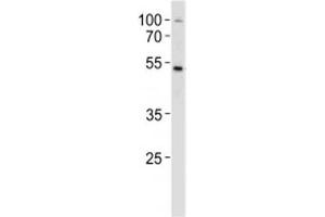 SOX4 antibody western blot analysis in MCF-7 lysate. (SOX4 Antikörper  (AA 269-297))