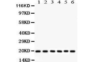 Anti- PIN1 Picoband antibody, Western blotting All lanes: Anti PIN1  at 0. (PIN1 Antikörper  (AA 1-163))