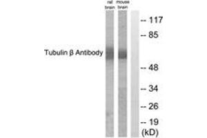 Western blot analysis of extracts from mouse brain/rat brain cells, using Tubulin beta Antibody. (TUBB Antikörper  (AA 401-450))