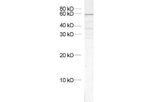 dilution: 1 : 1000, sample: crude synaptosomal fraction of rat brain (P2) (VPS45 Antikörper)