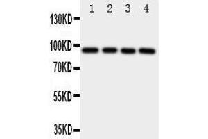 Western Blotting (WB) image for anti-Aryl Hydrocarbon Receptor (AHR) (AA 832-848), (C-Term) antibody (ABIN3043054) (Aryl Hydrocarbon Receptor Antikörper  (C-Term))