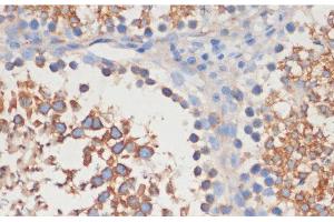 Immunohistochemistry of paraffin-embedded Rat testis using CDC42 Polyclonal Antibody at dilution of 1:100 (40x lens). (CDC42 Antikörper)