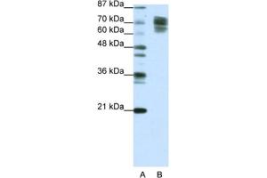 Western Blotting (WB) image for anti-Catenin (Cadherin-Associated Protein), beta 1, 88kDa (CTNNB1) antibody (ABIN2463774) (CTNNB1 Antikörper)