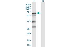 Western Blot analysis of SERPINA10 expression in transfected 293T cell line by SERPINA10 MaxPab polyclonal antibody. (SERPINA10 Antikörper  (AA 1-444))