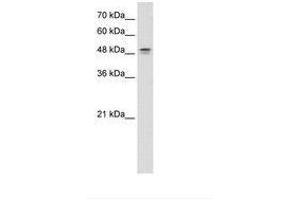 Image no. 1 for anti-Dihydroorotate Dehydrogenase (DHODH) (AA 101-150) antibody (ABIN6736624) (DHODH Antikörper  (AA 101-150))