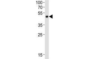 Western blot analysis of lysate from mouse cerebellum tissue lysate using Pax6 antibody diluted at 1:1000.