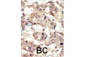 Immunohistochemistry (IHC) image for anti-EPH Receptor B6 (EPHB6) antibody (ABIN3003352) (EPH Receptor B6 Antikörper)