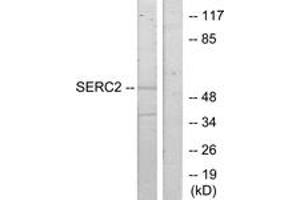 Western blot analysis of extracts from HeLa cells, using SERC2 Antibody. (PSAT1 Antikörper  (AA 341-390))