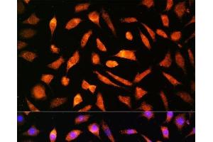 Immunofluorescence analysis of L929 cells using BNP Polyclonal Antibody at dilution of 1:100. (BNP Antikörper)