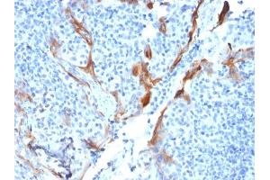 Formalin-fixed, paraffin-embedded human Tonsil stained with Cytokeratin 16 Mouse Recombinant Monoclonal Antibody (KRT16/1714). (Rekombinanter KRT16 Antikörper  (C-Term))