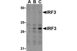 Western blot analysis of IRF3 in U937 whole cell lysate with AP30448PU-N IRF3 antibody at (A) 1, (B) 2, and (C) 4 μg/ml. (IRF3 Antikörper  (Intermediate Domain))