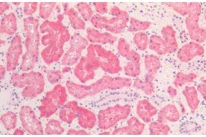 Immunohistochemistry analysis using Mouse Anti-HSP60 Monoclonal Antibody, Clone LK2 (ABIN361786 and ABIN361787). (HSPD1 Antikörper)