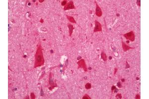 Immunohistochemistry (Paraffin-embedded Sections) (IHC (p)) image for anti-ELAV (Embryonic Lethal, Abnormal Vision, Drosophila)-Like 2 (Hu Antigen B) (ELAVL2) antibody (FITC) (ABIN2599933)