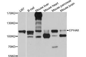 Western blot analysis of extracts of various cell lines, using EPHA8 antibody (ABIN5997684) at 1/1000 dilution. (EPH Receptor A8 Antikörper)
