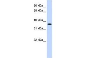 Image no. 1 for anti-Zinc Finger Protein 444 (ZNF444) (AA 108-157) antibody (ABIN6740452) (ZNF444 Antikörper  (AA 108-157))