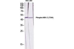 Western Blot (WB) analysis of specific cells using Phospho-MEK-2 (T394) Polyclonal Antibody.
