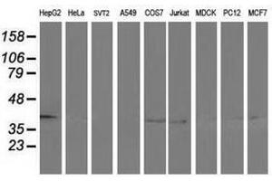 Image no. 2 for anti-Alcohol Dehydrogenase 1B (Class I), beta Polypeptide (ADH1B) antibody (ABIN1496477) (ADH1B Antikörper)