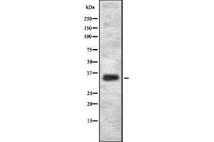 Western blot analysis OR2L2 using HepG2 whole cell lysates (OR2L2 Antikörper)