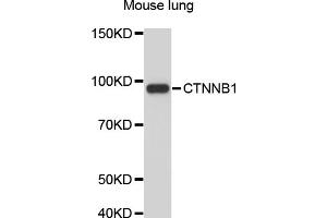 Western blot analysis of extracts of mouse lung, using CTNNB1 antibody (ABIN4903405). (CTNNB1 Antikörper)