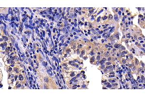 Immunohistochemistry (IHC) image for anti-Caspase 10, Apoptosis-Related Cysteine Peptidase (CASP10) (AA 223-459) antibody (ABIN7443104)