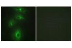 Immunofluorescence analysis of HeLa cells, using TMPRSS3 antibody.