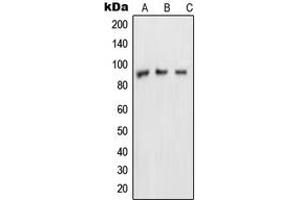 Western blot analysis of NUP88 expression in MDAMB453 (A), A431 (B), HeLa (C) whole cell lysates. (NUP88 Antikörper  (Center))
