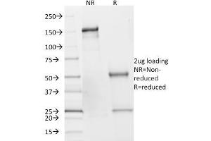 SDS-PAGE Analysis of Purified SDHB Mouse Monoclonal Antibody (SDHB/2382). (SDHB Antikörper  (AA 165-273))