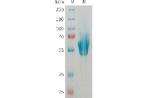 Human MAD Protein, His Tag on SDS-PAGE under reducing condition.