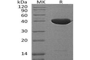 Western Blotting (WB) image for serpin Peptidase Inhibitor, Clade F (Alpha-2 Antiplasmin, Pigment Epithelium Derived Factor), Member 1 (SERPINF1) protein (ABIN7320733) (PEDF Protein)