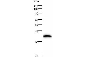 Western Blotting (WB) image for anti-HIR Histone Cell Cycle Regulation Defective Homolog A (HIRA) antibody (ABIN932202) (HIRA Antikörper)