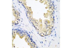 Immunohistochemistry of paraffin-embedded human prostate using SPINT2 antibody. (SPINT2 Antikörper)