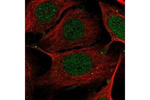 Immunofluorescent staining of U-2 OS with MEF2B polyclonal antibody  (Green) shows positivity in nucleus, cytoplasm and cell junctions.