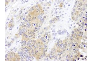 Immunohistochemistry (IHC) image for anti-Chaperonin Containing TCP1, Subunit 2 (Beta) (CCT2) (AA 325-375) antibody (ABIN7453613)