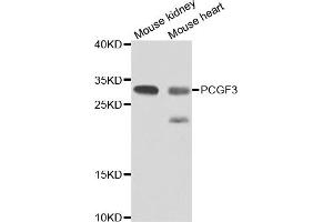 Western blot analysis of extracts of various cell lines, using PCGF3 antibody (ABIN4904703) at 1:1000 dilution. (PCGF3 Antikörper)