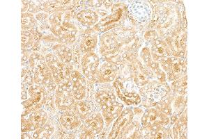 Immunohistochemistry (IHC) image for anti-Ribosomal Protein L7 (RPL7) (C-Term) antibody (ABIN7453643) (RPL7 Antikörper  (C-Term))