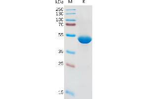 SDS-PAGE (SDS) image for Interleukin 1, beta (IL1B) (AA 117-269) protein (Fc Tag) (ABIN6964158)