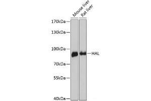 Western blot analysis of extracts of various cell lines using HAL Polyclonal Antibody at dilution of 1:3000.