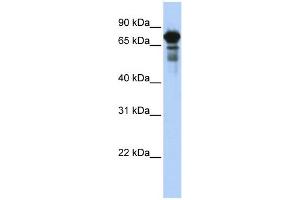 WB Suggested Anti-TRIM29 Antibody Titration:  0. (TRIM29 Antikörper  (Middle Region))