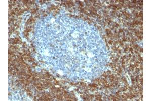 Formalin-fixed, paraffin-embedded human Tonsil stained with Bcl-2 Mouse Monoclonal Antibody (BCL2/796). (Bcl-2 Antikörper)